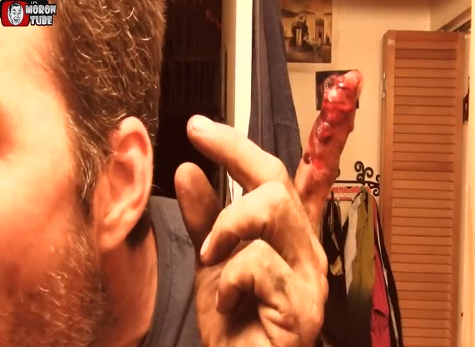 Video :A guy displays his terrible finger wound